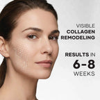 البشرة الزجاجية