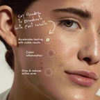 VEROTI - SKIN DEFENSE ACNE SPOT GEL